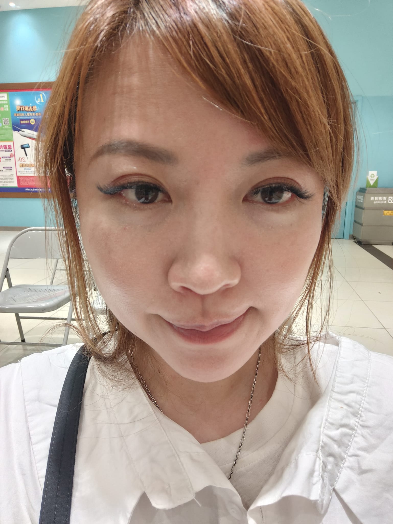 【醫美】今年生日也來恆美學!謝謝韓國帥歐巴院長 鄒承軒 讓我找回自信了!! - 第2張圖
