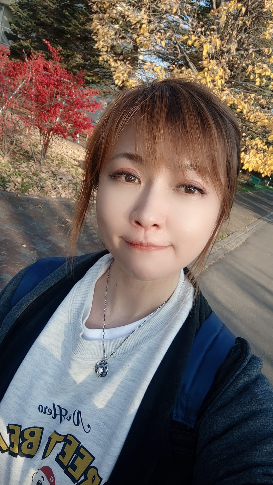 【醫美】今年生日也來恆美學!謝謝韓國帥歐巴院長 鄒承軒 讓我找回自信了!! - 第21張圖